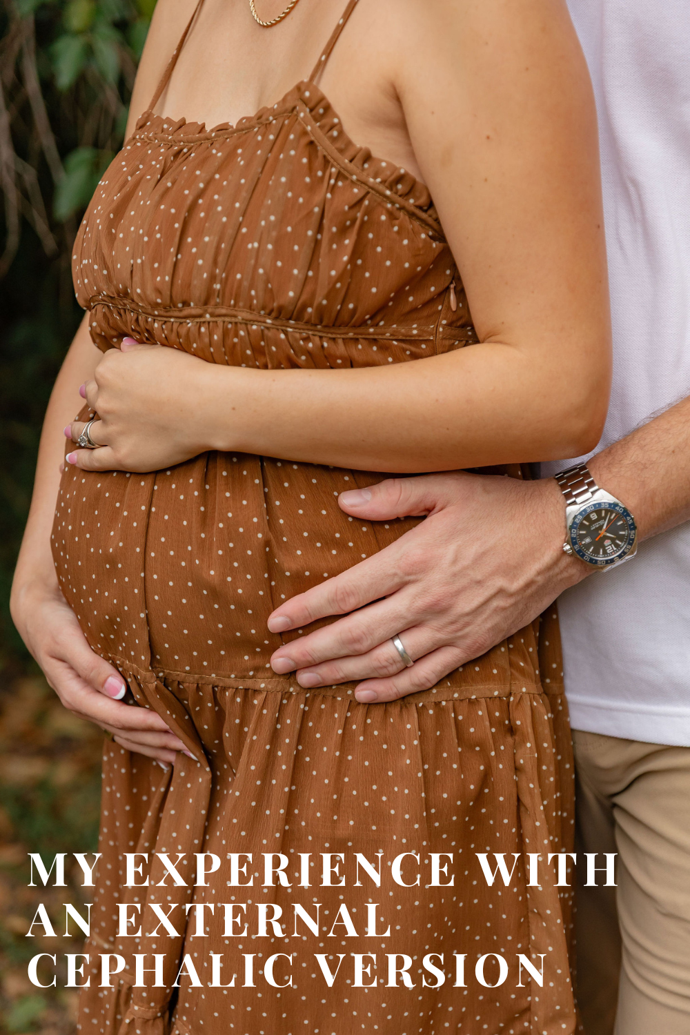 external cephalic version